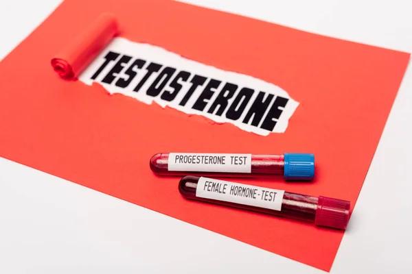 A Practical Guide to Testosterone Treatment for Adults